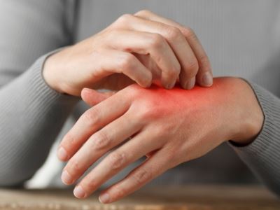 allergies and skin issues